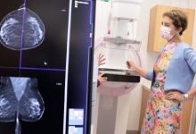 Photo of Cobertura GES: Solicitan mamografías gratuitas una vez al año