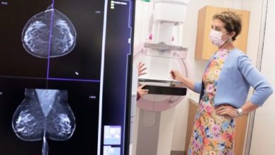 Photo of Cobertura GES: Solicitan mamografías gratuitas una vez al año