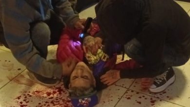 Photo of Grave joven baleado en Tocopilla