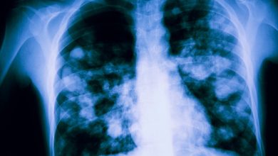 Photo of Colegio Médico Calama llama a no saturar servicios de urgencia para darle prioridad a niños