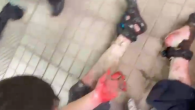 Photo of Explotan bombas molotov en  INBA hay 4 graves y 4 en riesgo vital