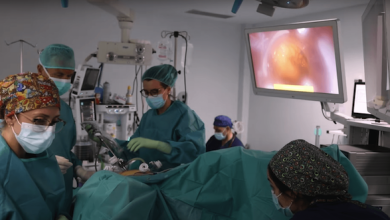 Photo of Día Mundial contra el Cáncer: expertos alertan aumento de casos en menores de 50 años y entregan recomendaciones