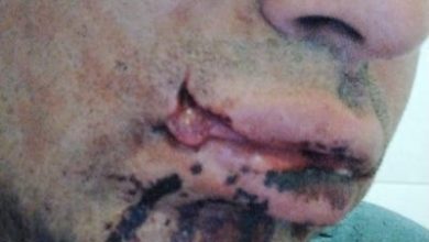 Photo of Graves lesiones sufrió colectivero de la línea 11 que le trataron de robar su auto