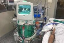 Photo of Inician sumario sanitario por negligencia médica de centro de diálisis Calama