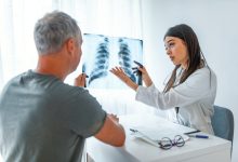 Photo of GES cubrirá tratamiento para dejar de fumar y prevenir el cáncer de pulmón