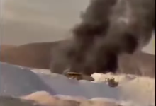 Photo of Minero de extracción de DMH Codelco Norte sufre quemadura del 18% de su cuerpo