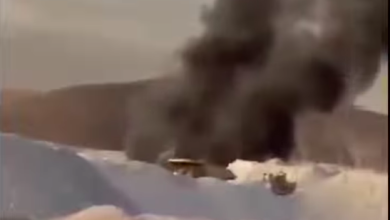 Photo of Minero de extracción de DMH Codelco Norte sufre quemadura del 18% de su cuerpo